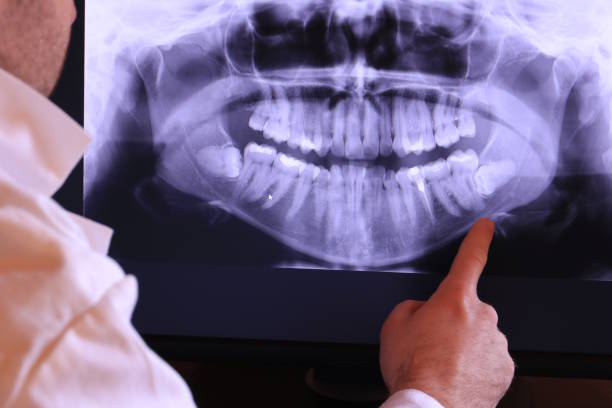Best Emergency Dentist for Special Needs Patients in Polk City, IA
