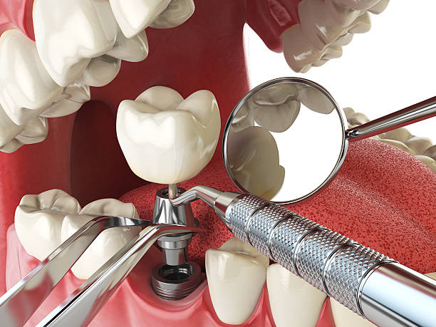 Best Emergency Dental Care for Abscessed Tooth in Polk City, IA